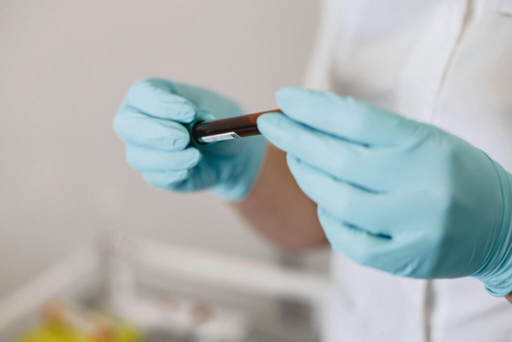 Cholesterol Screening in Houston: What Your Numbers Mean and How CARDIO Houston Helps Prevent Heart Disease