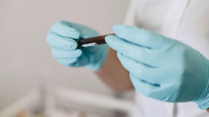 Cholesterol Screening in Houston: What Your Numbers Mean and How CARDIO Houston Helps Prevent Heart Disease